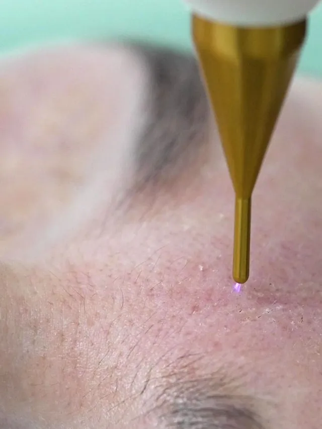 Limpieza facial