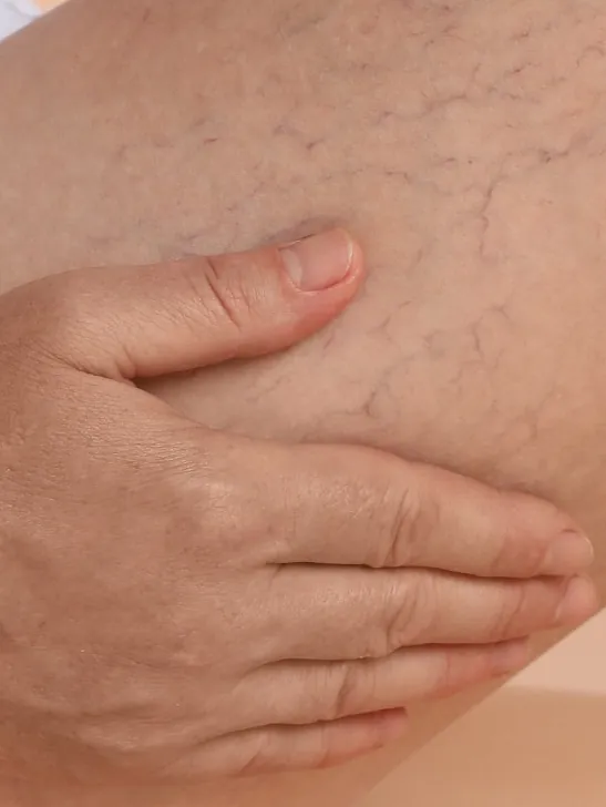 Limpieza facial
